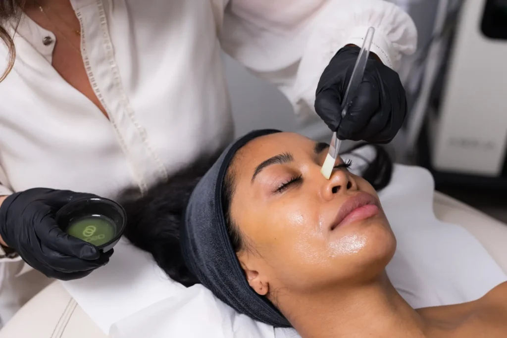 ASAP Fruchtsäure Behandlung bei Aurora im Beauty Salon Wien
