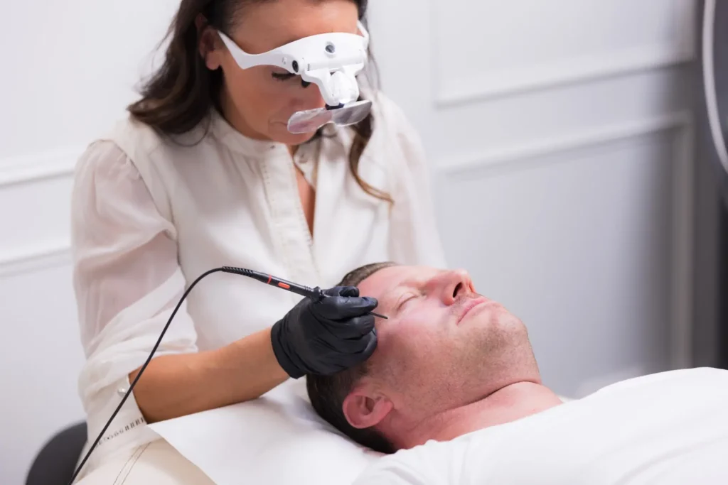 Couperose Behandlung bei Aurora im Beauty Salon Wien
