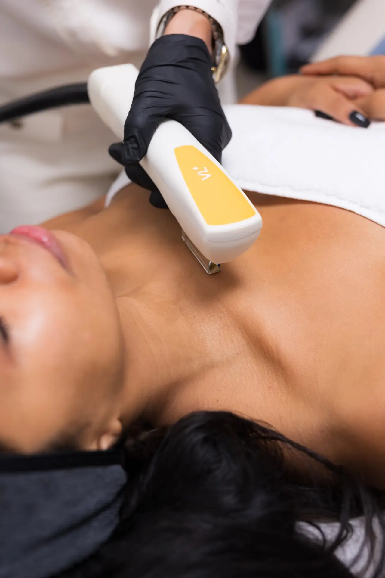Photorejuvenation mit IPL Aurora Körper